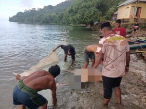Ridwan Dikenal Miliki Gangguan Penglihatan